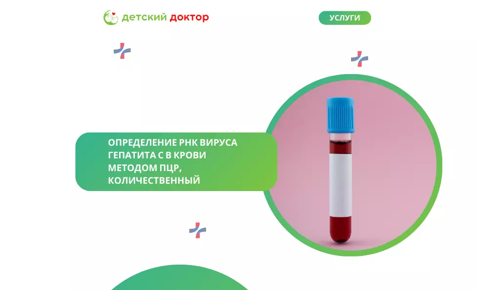 Определение РНК вируса гепатита С в крови методом ПЦР, количественный